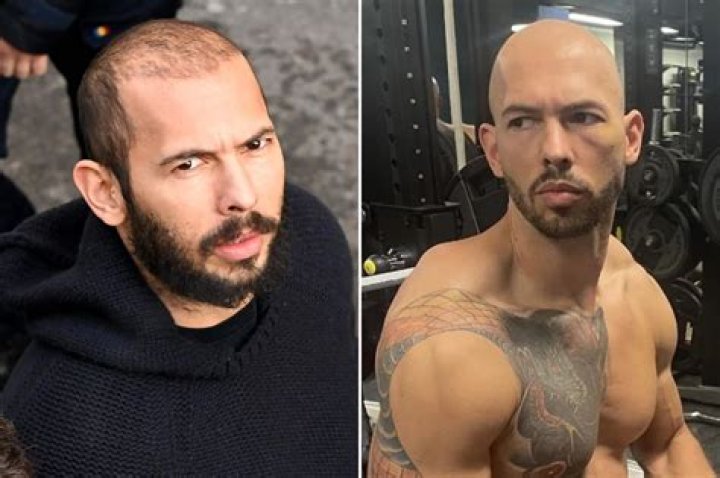 Andrew Tate mocked for boasting about his &lsquo;full head of hair&rsquo; as he&rsquo;s