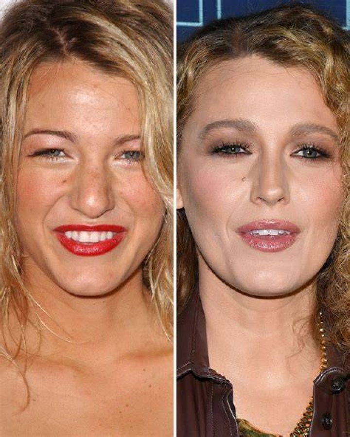 Blake Lively mostra antes e depois de nova gestação e brinca sobre