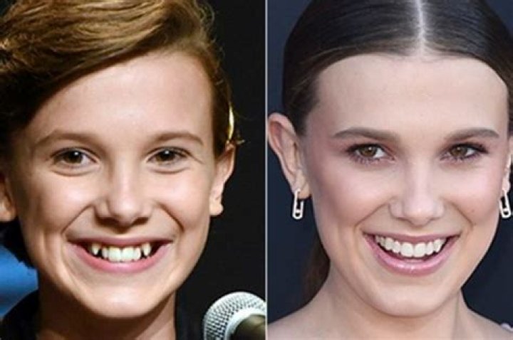 Celebrities who had bad teeth before they were stars HubPages