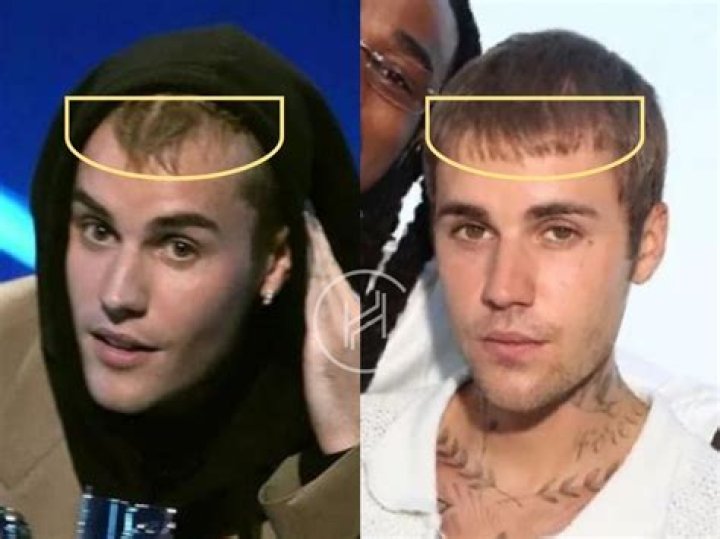Deceased: The Untimely Loss Of Justin Bieber