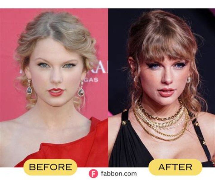 Did Taylor Swift get breast implants? Page Six