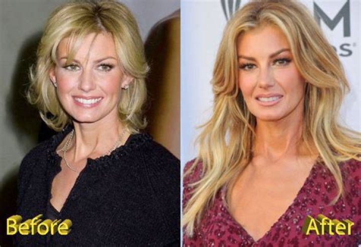 Faith Hill Plastic Surgery Country Star Beautiful Look