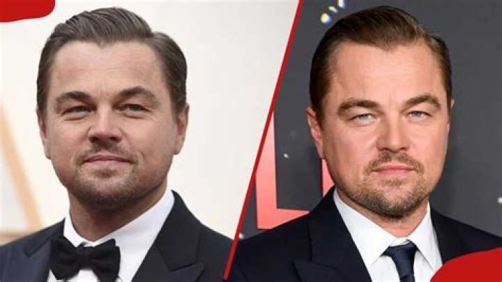 Famous People With A Cleft Lip & Palate (Cleft Lip & Palate Awareness