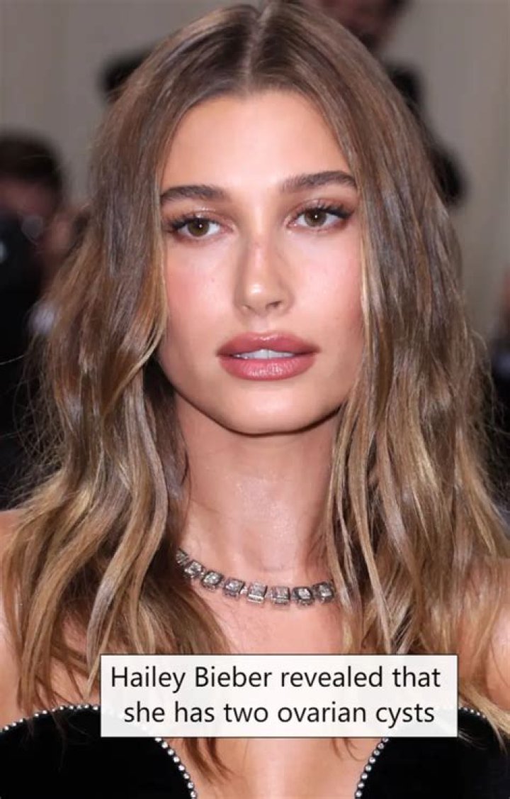 Hailey Bieber Has an Ovarian Cyst 'The Size of an Apple'…and It's Not