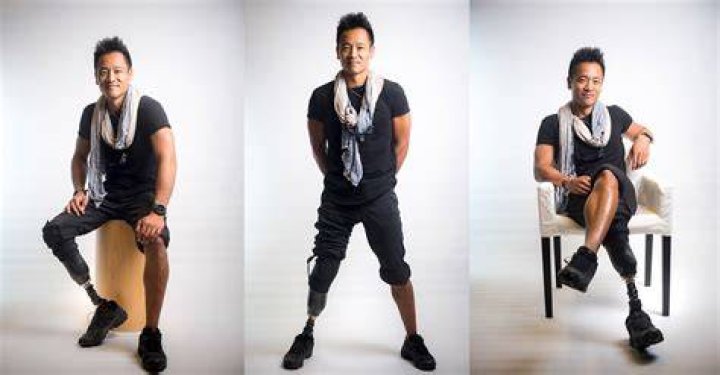 How did Albert Lin lose his leg? Shocking details behind accident