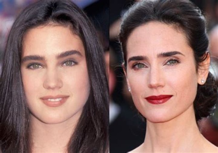 Jennifer Connelly plastic surgery (40) Celebrity plastic surgery online