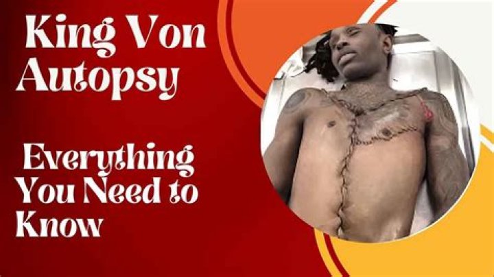 King Von Autopsy: The Full Story Of His Tragic Death