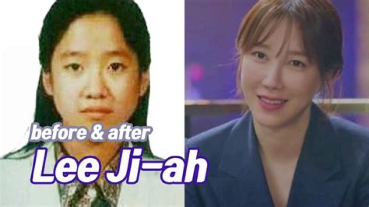 Lee Ji Ah Plastic Surgery Lee JiAh Before And After 답을 믿으세요