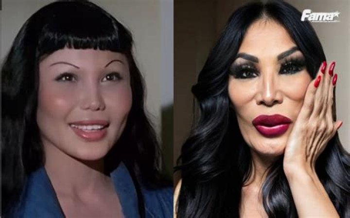 Lyn May Antes y despu&eacute;s de presumir su nuevo rostro Telemundo
