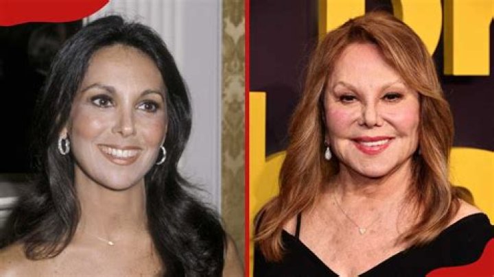 Marlo Thomas Plastic Surgery Facelift, Eyelid Surgery, Teeth Veneer