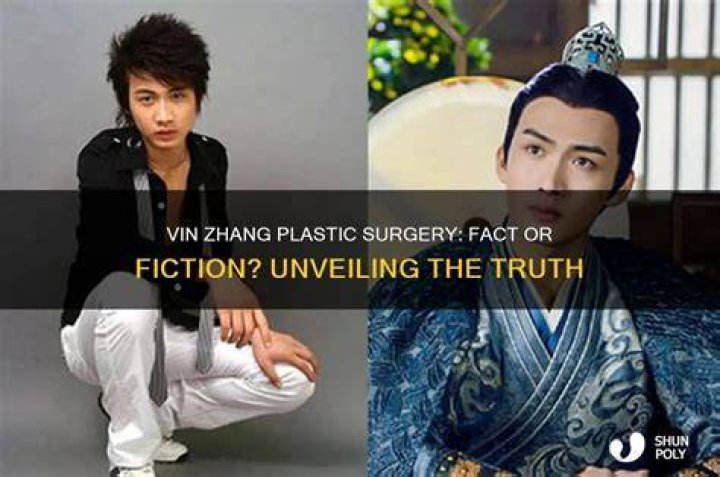 Unveiling The Truth: King Vin Autopsy Photos Revealed