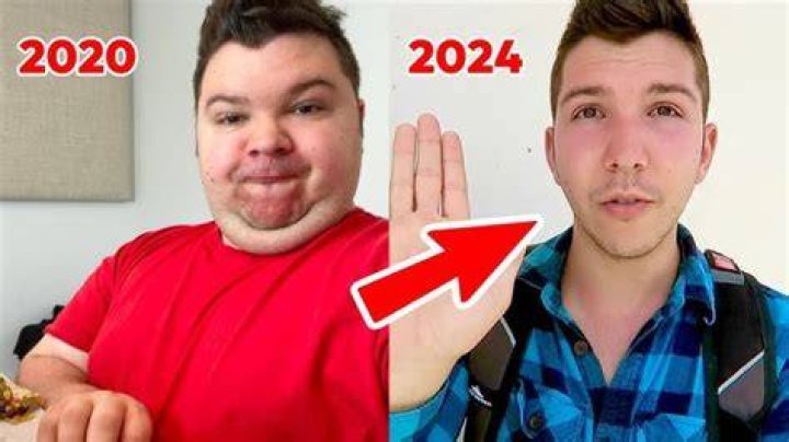What Happened to Nick Avocado? It is Unclear Whether His Health Issues